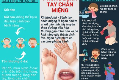 PHÒNG CHỐNG BỆNH TAY CHÂN MIỆNG Ở TRẺ