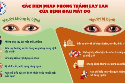 PHÒNG CHỐNG BỆNH ĐAU MẮT ĐỎ